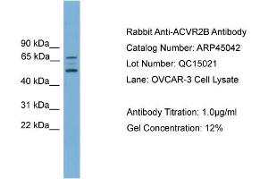 WB Suggested Anti-ACVR2B  Antibody Titration: 0. (ACVR2B 抗体  (Middle Region))