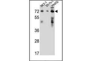 Western blot analysis of 17-beta-HSD4 / HSD17B4 Antibody (Center) in MCF-7, ZR-75-1, HepG2 cell line lysates (35ug/lane).