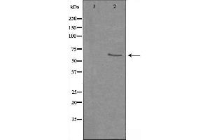 Western blot analysis of extracts from HUVEC cells using hnRNP Q antibody.