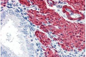 Human Uterus (formalin-fixed, paraffin-embedded) stained with TAGLN antibody ABIN337285 at 5 ug/ml followed by biotinylated anti-goat IgG secondary antibody ABIN481715, alkaline phosphatase-streptavidin and chromogen. (Transgelin 抗体  (AA 190-201))