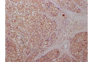 Immunohistochemistry (IHC) image for anti-Enolase 1 (ENO1) (AA 2-434) antibody (ABIN7143869)