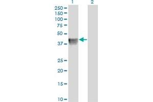 Western Blot analysis of BGN expression in transfected 293T cell line by BGN monoclonal antibody (M01), clone 4E1-1G7. (Biglycan 抗体  (AA 1-368))