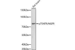 Western blot analysis of extracts of Rat brain, using (ABIN6127593, ABIN6144613, ABIN6144615 and ABIN6215090) at 1:1000 dilution. (NGFR 抗体  (AA 273-427))