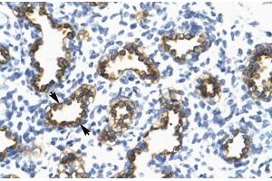 Human Lung; RFP2 antibody - middle region in Human Lung cells using Immunohistochemistry (TRIM13 抗体  (Middle Region))