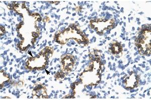 Human Lung; RFP2 antibody - middle region in Human Lung cells using Immunohistochemistry (TRIM13 抗体  (Middle Region))