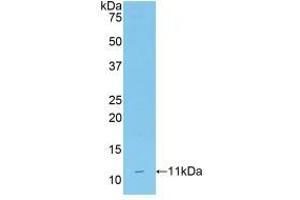 Western blot analysis of recombinant Mouse CD3d. (CD3D 抗体  (AA 22-104))