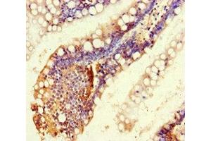 Immunohistochemistry of paraffin-embedded human small intestine tissue using ABIN7167648 at dilution of 1:100 (RTEL1 抗体  (AA 975-1219))