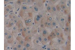 DAB staining on IHC-P; Samples: Human Liver Tissue (SRF 抗体  (AA 231-474))
