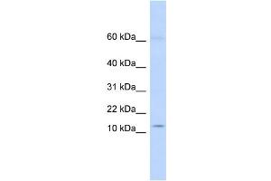 WB Suggested Anti-KRTAP8-1 Antibody Titration:  0. (KRTAP8-1 抗体  (Middle Region))