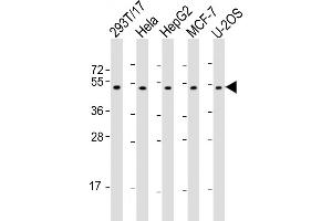 All lanes : Anti-PLAGL1 Antibody (N-Term) at 1:2000 dilution Lane 1: 293T/17 whole cell lysate Lane 2: Hela whole cell lysate Lane 3: HepG2 whole cell lysate Lane 4: MCF-7 whole cell lysate Lane 5: U-2OS whole cell lysate Lysates/proteins at 20 μg per lane. (PLAGL1 抗体  (AA 112-146))