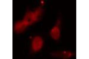 ABIN6273522 staining HeLa cells by IF/ICC. (PMS2 抗体  (C-Term))