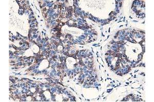 Immunohistochemical staining of paraffin-embedded Human breast tissue using anti-NUDT18 mouse monoclonal antibody. (NUDT18 抗体)