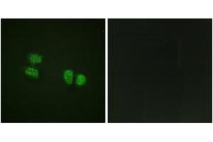 Immunofluorescence analysis of HeLa cells, using DDX5/DEAD-box Protein 5 (Phospho-Tyr593) Antibody. (DDX5 抗体  (pTyr593))