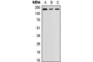 Western blot analysis of Laminin beta 1 expression in A431 (A), SW480 (B), PC3 (C) whole cell lysates. (Laminin beta 1 抗体  (C-Term))