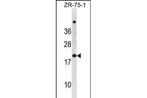 CDKN2A Antibody (N-term S8) (ABIN6243104 and ABIN6577380) western blot analysis in ZR-75-1 cell line lysates (35 μg/lane). (CDKN2A 抗体  (N-Term))