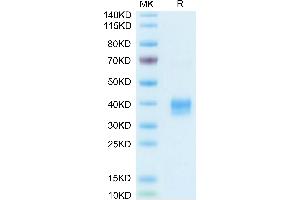 Biotinylated Mouse Siglec-15/CD33L3 on Tris-Bis PAGE under reduced condition. (SIGLEC15 Protein (AA 24-262) (His tag,Biotin))