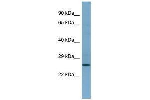 APIP antibody used at 1 ug/ml to detect target protein. (APIP 抗体  (Middle Region))