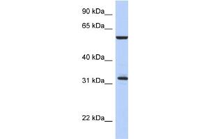 WB Suggested Anti-CDC34 Antibody Titration:  0. (CDC34 抗体  (Middle Region))