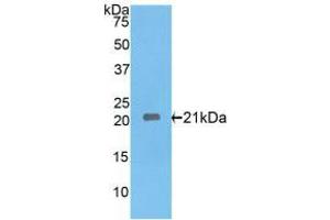 Western blot analysis of recombinant Rat IL17RE. (IL17RE 抗体  (AA 457-626))