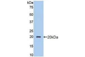 Detection of Recombinant PROCR, Human using Polyclonal Antibody to Endothelial protein C receptor (EPCR) (PROCR 抗体  (AA 63-205))