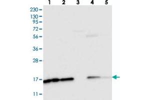 Western blot analysis of Lane 1: RT-4, Lane 2: U-251 MG, Lane 3: Human Plasma, Lane 4: Liver, Lane 5: Tonsil with NDUFAF3 polyclonal antibody . (NDUFAF3 抗体)