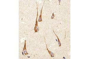 Immunohistochemical analysis of paraffin-embedded H. (PDIA6 抗体  (AA 144-172))