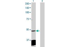 Western Blot analysis of CLP1 expression in transfected 293T cell line by CLP1 MaxPab polyclonal antibody. (CLP1 抗体  (AA 1-425))