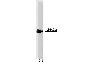Western blot analysis of FADD on a A431 lysate. (FADD 抗体  (AA 94-208))