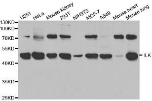 Western blot analysis of extracts of various cell lines, using ILK antibody. (ILK 抗体  (AA 1-260))