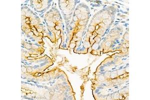 Immunohistochemistry (Paraffin-embedded Sections) (IHC (p)) image for anti-Carcinoembryonic Antigen-Related Cell Adhesion Molecule 1 (CEACAM1) antibody (ABIN7073315)