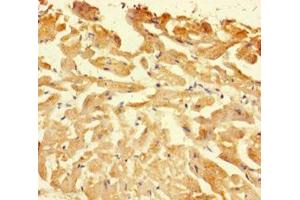 Immunohistochemistry of paraffin-embedded human heart tissue using ABIN7146926 at dilution of 1:100 (Caspase 1 抗体  (AA 120-269))