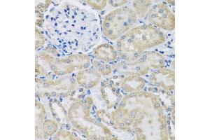 Immunohistochemistry of paraffin-embedded rat kidney using DCP2 antibody at dilution of 1:100 (x40 lens). (DCP2 抗体)