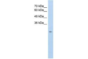 WB Suggested Anti-SLC25A45 Antibody Titration:  5. (SLC25A45 抗体  (C-Term))