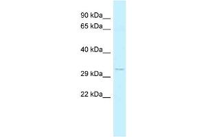 WB Suggested Anti-FOXK2 Antibody Titration: 1. (Forkhead Box K2 抗体  (C-Term))