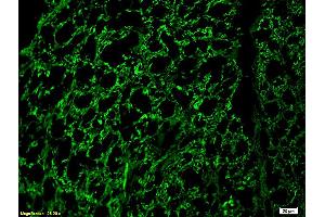 Formalin-fixed and paraffin embedded rat spinal cord labeled with Rabbit Anti-NF-H/Neurofilament H/Neurofilament 200 Polyclonal Antibody (ABIN672156), Unconjugated 1:200 followed by conjugation to the secondary antibody and DAB staining. (NEFH 抗体  (AA 1-100))