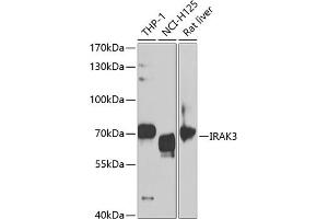 Western blot analysis of extracts of various cell lines, using IR antibody (ABIN6130501, ABIN6142519, ABIN6142521 and ABIN6221129) at 1:1000 dilution. (IRAK3 抗体  (AA 367-596))