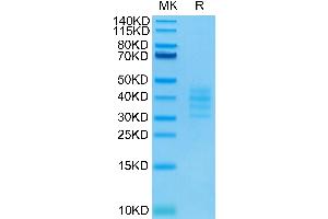 Biotunylated Human BCMA Trimer on Tris-Bis PAGE under reduced condition. (BCMA Protein (Trimer) (His-Avi Tag,Biotin))