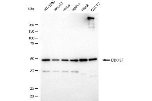 Western blotting analysis using DDOST antibody (ABIN7798383). (DDOST 抗体)