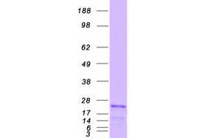 Validation with Western Blot