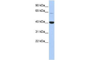WB Suggested Anti-MBD1 Antibody Titration:  0. (MBD1 抗体  (Middle Region))