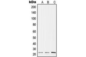 Western blot analysis of RPL17 expression in A375 (A), Raw264. (RPL17 抗体  (Center))