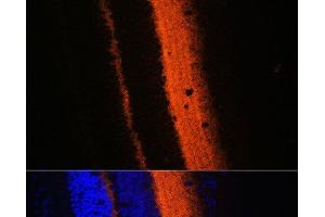Immunofluorescence analysis of Mouse eye using SYT1 Polyclonal Antibody at dilution of 1:100 (40x lens). (SYT1 抗体)