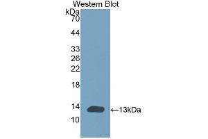 Detection of Recombinant CHRNa1, Human using Polyclonal Antibody to Cholinergic Receptor, Nicotinic, Alpha 1 (CHRNa1) (CHRNA1 抗体  (AA 21-255))