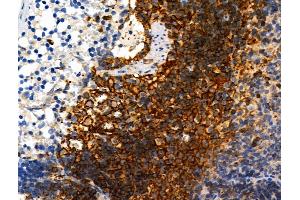 Phospho-ZO-2 (Tyr1118) Antibody at 1/100 staining Rat spleen tissue by IHC-P. (TJP2 抗体  (pTyr1118))