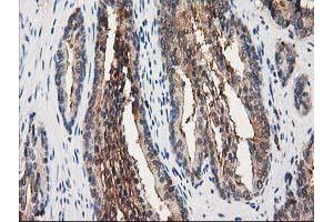 Image no. 1 for anti-Annexin A3 (ANXA3) antibody (ABIN1496642) (Annexin A3 抗体)