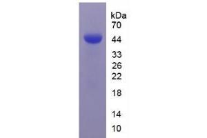 SDS-PAGE analysis of Human Carbonic Anhydrase IX Protein. (CA9 蛋白)