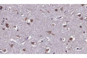Immunohistochemistry (IHC) image for anti-Solute Carrier Family 28 (Sodium-Coupled Nucleoside Transporter), Member 2 (SLC28A2) (Internal Region) antibody (ABIN6258323)