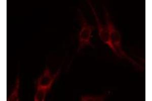 ABIN6274320 staining HepG2 by IF/ICC. (LTB 抗体  (C-Term))