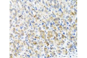 Immunohistochemistry of paraffin-embedded Mouse stomach using RAD51C Polyclonal Antibody at dilution of 1:100 (40x lens). (RAD51C 抗体)