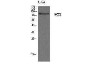 Western Blotting (WB) image for anti-NADPH Oxidase 5 (NOX5) (C-Term) antibody (ABIN3185943)